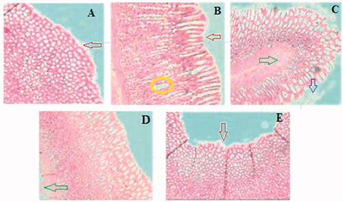 Figure 7. Effect of GCE on the histology of ethanol-induced stomach mucosal injury. (A) Normal control group showing intact mucosal lining with flattened epithelial cells and no lesions. (B) Ulcer control group showing severe disruption of surface epithelium (red arrow) and haemorrhagic necrotic longitudinal lesion (yellow circle) and edoema of submucosal layer. The animal pre-treated with GCE in (C) 200 mg/kg and (D) 400 mg/kg groups shows moderate to mild disruption of surface epithelium; reduction in submucosal edoema (green arrow) and surface epithelium is partially restored in a dose-dependent manner. (E) Ranitidine showing mild disruption of the surface epithelium (red arrow), deep mucosal necrosis is absent but mucosal edoema persists.