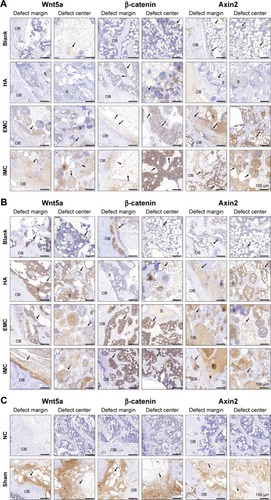 Figure 5 Immunohistochemical analysis of positively stained cells in the defect regions of different groups.Notes: (A) At day 7. (B) At day 14. (C) The sham surgery group without primary antibody was used as a NC. Black arrows indicate positively stained cells.Abbreviations: EMC, extrafibrillar mineralized collagen; HA, nano-hydroxyapatite; IMC, intrafibrillar mineralized collagen; NC, negative control; OB, old bone; S, scaffold materials.