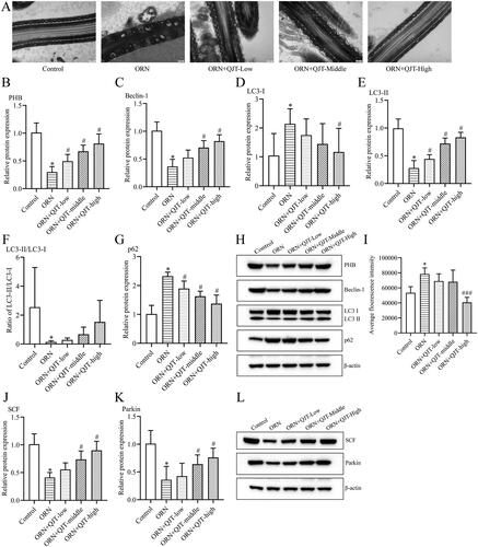 Figure 3. QJT increased mitophagy and mitochondrial ubiquitination of ORN-treated rats. (A) Mitochondria were evaluated by TEM. (B–H) Relative protein levels of PHB (B), Beclin-1 (C), LC3 (D–F) and p62 (G) were detected by western blotting. (I) ROS level was determined by a flow cytometer. (J–K) Relative protein levels of SCF (J) and Parkin (K) were measured by western blotting. Data were expressed after being normalized to β-actin. *p < 0.05 vs. Control group. #p < 0.05 vs. ORN group. All assays were performed five times.