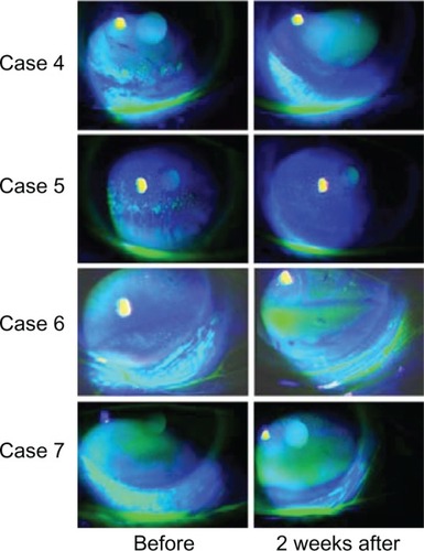 Figure 4 Cases 4, 5, 6, and 7.