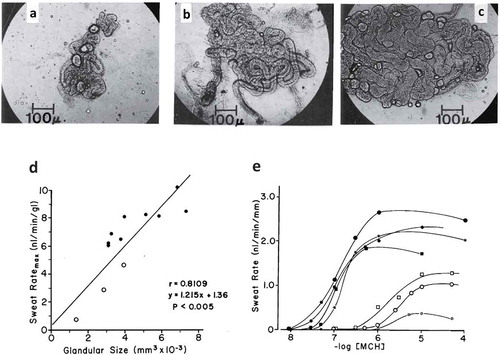 Figure 4. Top row (panels A-C): Variation in the size of human eccrine sweat glands taken from the backs of three different men who were described as poor (A), moderate (B), and heavy sweaters (C). Bottom row: Correlation between size of sweat gland and sweat ratemax per gland (panel D). Dose-response curves (expressed per unit length of tubule) of sweat rates of 7 men to methacholine. Closed symbols show moderate to heavy sweaters. Open symbols show poor sweaters. Reprinted from Sato and Sato 1983 [Citation131]with permission.