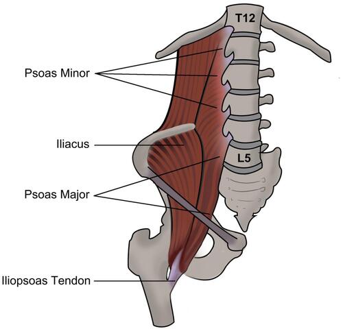 Figure 2 The anatomic relation of iliopsoas and the spine.