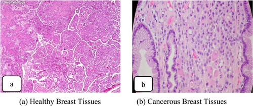 Figure 1. (a) Healthy Breast Tissues (b) Cancerous Breast Tissues.
