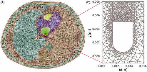 Figure 3. (A) 2D model mesh. (B) Detail of mesh around the active electrode.