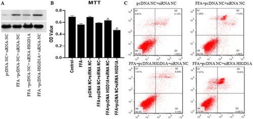 Figure 5. Overexpression of HIGD1A protects cells from apoptosis under high-fat exposure and vice versa. cells in the FFA + pcDNA HIGD1A + siRNA NC group exhibited increased HIGD1A expression compared with those in the FFA + pcDNA NC + siRNA NC group and cells in the FFA + pcDNA NC + siRNA HIGD1A group exhibited decreased HIGD1Aexpression compared with those in the FFA + pcDNA NC + siRNA NC group in HepG2.2.15 cells (a). cell proliferation in each group was measured by the MTT kit in HepG2.2.15 cells (B), and cell apoptosis in each group was measured by flow cytometry using Annexin V-FITC staining in HepG2.2.15 (C) (∗p < 0.05 compared with the FFA + pcDNA NC + siRNA NC group).