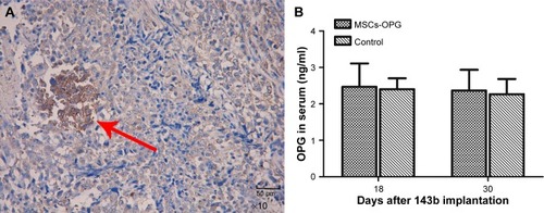 Figure 5 Expression of OPG in mice bearing osteosarcoma.