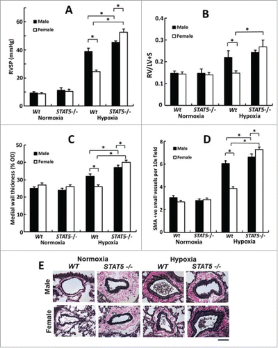 FIGURE 6. Female mice develop the severest PH in response to chronic hypoxia after homozygous SM22-Cre, STAT5a/b−/− deletion (7 weeks' of hypoxia; n= 5 per group). Panel A, RVSP; Panel B, RVH; Panels C, PA remodeling in terms of wall thickness; Panel D: PA remodeling in terms of SMA-positive vessels; Panel E, Van Gieson's elastin staining. Scale bar = 45 µm). *P <0.05. Adapted from Sehgal et al (2014).Citation83