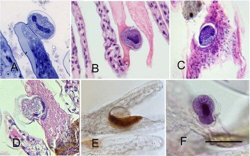 Figure 16. Light microscopy of Litopenaeus setiferus gills with Hyalophysa lynni trophonts. A. Noninvasive form, plastic section. The elongated macronucleus with round chromatin masses is visible. B-D. Paraffin sections of invasive forms, revealing the cell (within the cyst) extending into host tissue. E-F. Whole mount preparations with a trophont cyst nestled within a melanization scar (E) and an actively invading trophont stage (F). A. Toluidine blue. B-D. H & E. E. Silver nitrate stain. F. Hematoxylin. Scale bar 50 µm for each. Figure F used with permission from Landers et al. (Citation2020). Remaining figures are new.
