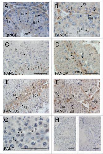 Figure 2. FANC protein localization in the adult mouse testis. (A) FANCB was localized in the nucleus and cytoplasm of Sertoli cells (SC), in the cytoplasm of type and Intermediate spermatogonia (Sg) and of pachytene spermatocytes (PS) in the early stages of spermatogenesis. Round spermatids (rST) showed no discernible staining, however elongated spermatids (eST) showed cytoplasmic staining. (B) FANCG was detected in the cytoplasm of type A (A) and type B spermatogonia (B), and in the cytoplasm of pachytene spermatocytes (PS). Nuclear staining of elongating spermatids (eST) was also evident. Peritubular myoid cells (PTM) were also immunostained. (C) FANCL was only detected in the nuclei of spermatids just prior to, and during elongation, with the immunostaining becoming more intense in step 10 (see arrows in stage X tubule) compared to step 9 (see arrows in stage IX tubule). The Roman numerals indicate the stage of the tubule whereas the arrows indicate an elongating spermatid within each tubule (D) FANCM was localized in the cytoplasm of Sertoli cells (SC) and in the cytoplasm and Golgi of leptotene-zygotene spermatocytes (L-Z). Late pachytene spermatocytes (PS) were not obviously immunostained above background, nor were round spermatids (rST). Peritubular myoid cells (PTM) showed some staining. (E) FANCD2 was present in the Sertoli cell (SC) nuclei at stage VII and in spermatogonia (Sg), preleptotene spermatocytes (Pl) and pachytene spermatocytes (PS). Round spermatids (rST) were not obviously immune-labeled. (F) FANCI was present in the nucleus (red arrows) and cytoplasm (black arrow) of Sertoli cells (SC). It was also apparent in the nucleus of spermatogonia (Sg) but was absent from pre-leptotene – leptotene (P-L) spermatocytes. Other cells including pachytene spermatocytes (PS), round spermatids (rST) and elongated spermatids (eST) were not obviously immunostained. G. FANCJ was evident in the nucleus of some spermatogonia (Sg), including type B spermatogonia (B) but showed little immunostaining in Sertoli cells (SC). (H, I) Negative controls for the immunohistochemistry, whereby the primary antibody was omitted. The bar in each micrograph represents 50 μM.