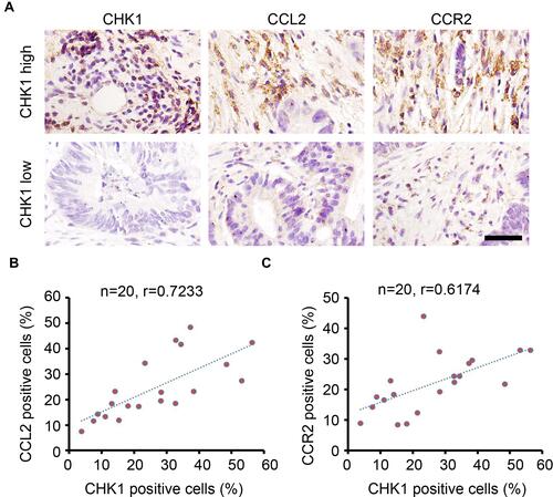 Figure 6 CHK1 correlates with CCL2 and CCR2 expression in colorectal cancer tissues. (A) IHC staining of CHK1, CCL2 and CCR2 expression in colorectal cancer tissues. Scale bar = 100 μm. (B) Correlation analysis of the percentage of CHK1 and CCL2 positive cells in each sample (n=20, r = 0.7233). (C) Correlation analysis of the percentage of CHK1 and CCR2 positive cells in each sample (n=20, r = 0.6174).