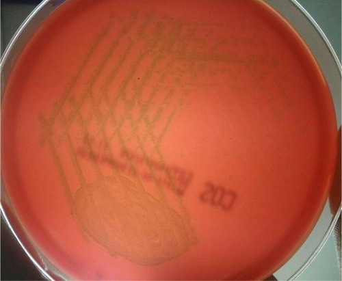 Figure 4 Culture of aspirated vitreous fluid shows growth of Streptococcus mitis (culture media: blood agar).