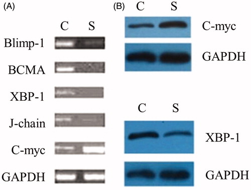 Figure 5. The effect of Blimp-1 inhibition on the expression of BCMA, XBP-1, J-chain, and C-myc. Western blot and RT-PCR were performed 3 weeks after administration of the lentivirus Blimp-1 siRNA (study group) or PLL3.7 (control group). (A) Peripheral blood of the mice (8 mice per group) was collected, and mRNA expression of Blimp-1, BCMA, XBP-1, J-chain, and C-myc were detected by RT-PCR. (B) Spleen cells of mice were collected, and protein expression of XBP-1 and C-myc were detected by Western blot. Similar results were obtained from three individual experiments. C: control group, S: study group.
