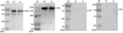 Figure 3 RCC cells were found to express carboxypeptidase M and carboxypeptidase D, but not carboxypeptidase N or carboxypeptydase Z.