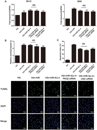 Figure 4 Restoration of GLP-1R expression by knockdown of PKCβ insignificantly recovers anti-apoptotic effects of GLP-1R in H9C2 cells cultured by high glucose. (A) QRT-PCR analysis of Bcl-2 and BAX. (B) Caspase-3 activity. (C) Representative TUNEL images and quantitative analysis of the TUNEL results (shown as apoptosis index).