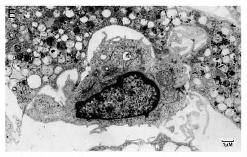 Figure 3E. (E) A typical Hematopoietic Stem Cell (HSC) niche. Shown is a small HSC with a high nucleo-cytoplasmic ratio and prominent nucleoli, embedded in an adipocyte full of lipid droplets. Strong plasma membrane interdigitation is observed between the adipocyte and the HSC, suggesting possible lipid transport.