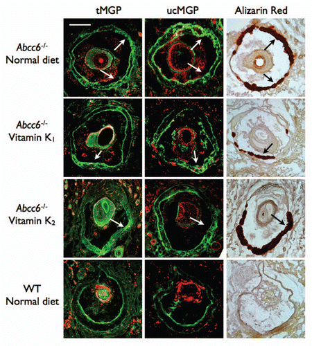 Figure 8 Immunofluorescent detection of MGP in the vibrissae's capsule of mice fed diets enriched with 100 mg/kg of vitamin K1 and MK4. Frozen serial sections from the muzzle tissue were used for both immunofluorescent and Alizarin S Red staining. We observed large positive staining of both ucMGP and tMGP (green) in the calcified regions of the vibrissae's capsule of Abcc6-/- mice fed with normal or vitamin K-enriched diets (Arrows), suggesting that the carboxylation status of MGP in these tissues is unaffected by increased dietary vitamin K1 or MK4. The counterstaining on immunofluorescent images was obtained with propidium iodide. The scale bar represents 200 µm.