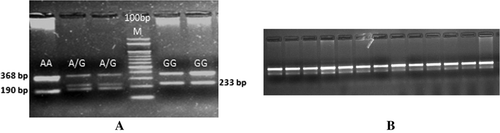 Figure 1.  Tetra-ARMS-PCR to differentiate three genotypes of 1551A > G SNP in Chilika buffalo (A) and fixation of GG genotype in other riverine and swamp buffaloes (B).