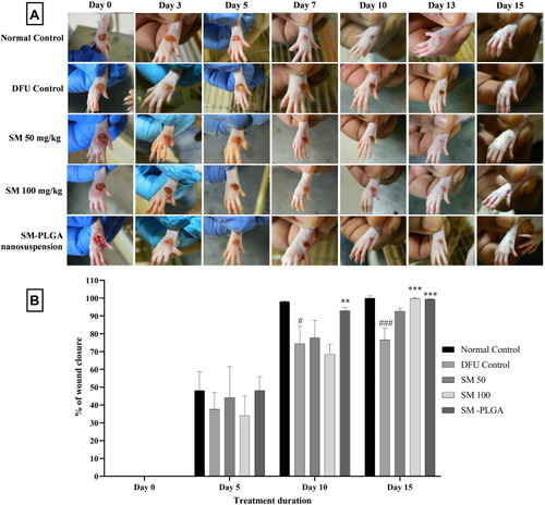 Figure 8 (A) Representative images of DFU of treatments at 0, 3, 5, 7, 10, 13 and 15 days (B) Effect of SM-PLGA nanosuspension on wound closure in HFD+ STZ induced Type-II diabetic rats. Data represented as mean ± SEM, n=6. #p<0.05, ###p<0.001 when compared with NC, **p<0.01 and ***p<0.001 when compared with the DFU. Samples were analysed by two-way ANOVA with Bonferroni post-hoc test.