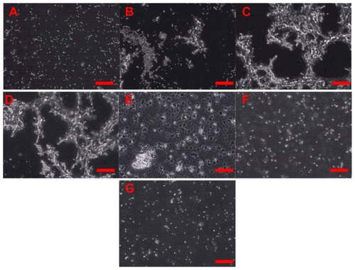 Figure 4 Amorphous SiNP induce platelet aggregation. Platelets were exposed to 10 μg/mL 10-nm SiNP in the absence (C) or present of inhibitors of platelet aggregation (D–G). Unstimulated (resting) platelets (A) and platelet aggregation induced by collagen (B) are also shown. Previous to the exposure to 10SiNP, platelets were incubated with acetylsalicylic acid (D), phenanthroline (E), apyrase (F) and a mixture of these three inhibitors (G).Note: Scale bars represent 100 μm.Abbreviation: SiNP, silica nanoparticles.