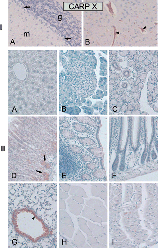 Figure 6.  Immunohistochemical staining of carbonic anhydrase-related protein X (CARP X) protein in mouse tissues. Panel I. Expression of CARP X in the brain. (A) There was no expression in cerebellum. (B) The arrowheads in figure show CARP X-positive microcapillaries in the cerebrum. Panel II. Moderate CARP X expression was observed in the respiratory epithelium (arrowhead) of the lung (G). Moderate expression was also present in the gastric glands (arrows in panel D). The heart muscle cells occasionally showed extremely weak signals (I). The other tissues including the (A) liver, (B) pancreas, (C) submandibular gland, (E) colon, (F) small intestine, (H) skeletal muscle remained negative. Original magnifications are at ×20. Adopted from Aspatwar et al.Citation12