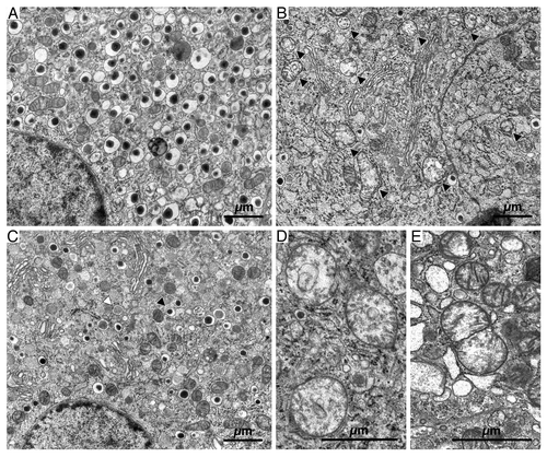Figure 4. Electron microscopy showing representative sections of β-cells from transplanted islets to non-diabetic, vehicle-treated (A), diabetic, vehicle-treated (B and D) and diabetic, tifenazoxide-treated (C) rats. (E) shows an example of a likely fusion event in a section from a diabetic vehicle-treated rat. In (B) black arrows = mitochondria. In (C) black arrows = mature granule and white arrows = immature granule.