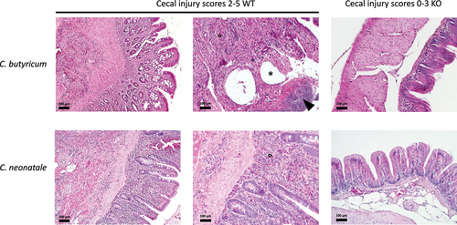 Figure 6. Histopathological presentation of the cecum (hematoxylin–eosin–safranin staining). The ceca infected with C. butyricum wild-type (WT) shows severe mucosal thickening secondary to massive mixed inflammatory cell infiltration (°). The focal ulceration (arrowhead) overlaid by bacterial colonies and gas pocket formation (pneumatosis) (*) are highlighted. The ceca infected with the C. butyricum hbd-knockout (KO) strain are unremarkable. The WT C. neonatale strain also elicited marked mucosal thickening secondary to massive mixed inflammatory cell infiltration of all layers of the cecal wall (°). The ceca infected with C. neonatale KO are unremarkable.