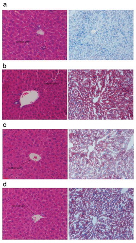 Figure 4. Effects of CGMCC 3917 on ethanol-induced hepatotoxicity in mice. (a) normal mice (b) ethanol mice, (c) ethanol+CGMCC 3917 (108 CFUs/mL) treated mice, and (d) ethanol+CGMCC 3917 treated mice (106 CFUs/mL) (200 × magnification).Figura 4. Efectos de CGMCC 3917 sobre la hepatotoxicidad inducida por etanol en ratones. (a) ratones normales (b) ratones tratados con etanol, (c) ratones tratados con etanol + CGMCC 3917 (108 UFC/ml) y (d) ratones tratados con etanol + CGMCC 3917 (106 UFC/ml) (200 × aumentos).