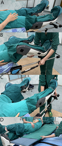 Figure 3 Direct over-bed method. Placement—(A): Leg supports of the stirrup variety were utilized at the end of the surgical bed; (B): Positioning. Repositioning—(C): Adjusting handle directly to Reposition; Transition to the bed—(D): Transition to the bed.
