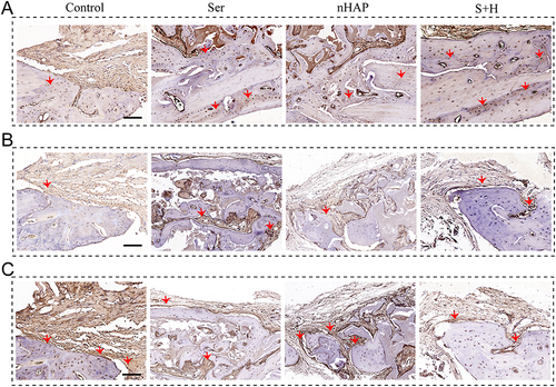 Figure 7 Immunohistochemical staining of COLI, Arg-1, and iNOS after implantation for 8 weeks. (A–C) Representative photographs of immunohistochemical staining of (A) COLI, (B) Arg-1, and (C) iNOS. Scale bar = 100μm. Red arrows represent relatively typical protein staining areas.