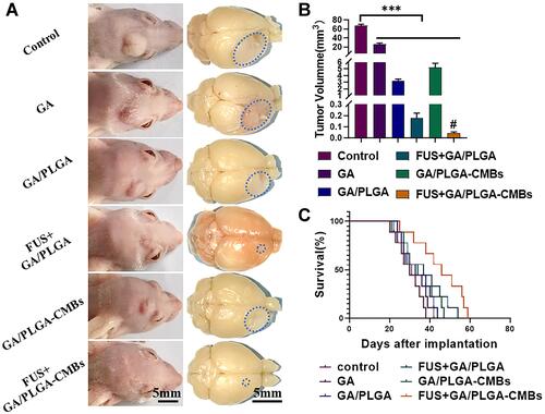 Figure 12 The anti-tumor effect was evaluated by general index. (A) After 37 days of modeling, the mice in different treatment groups corresponded to the gross view of glioma. (B) Quantification of tumor volume in mice with different treatment groups (***p<0.001 versus control group, #p<0.05 versus each other group). (C) The survival rate of six groups of mice was counted. The life cycle of mice in FUS+GA/PLGA-CMBs group was the longest, which was 59 days.