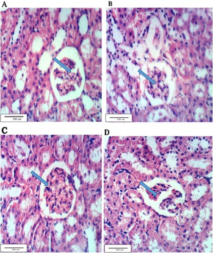 Figure 1. A. Kidney section of G1 showing the normal renal tissue, B: Kidney section of G2 with vacuolated epithelial lining and atrophy of glomerular tufts, C: Kidney section of G3 showing no histopathological changes, D: Kidney section of G4 showing normal tissues (H & E ×400).