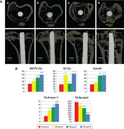 Figure 5 The transverse and longitudinal micro-CT images of proximal tibiae (A) and quantitative evaluation results after implantation for 12 weeks (B).Notes: *P<0.05 vs group A; #P<0.05 vs group B; $P<0.05 vs group C. (a) Group A; (b) group B; (c) group C; (d) group D. Group A, control implant without any other treatment; group B, anodized TiO2 nanoporous implant; group C, control implant with PRP treatment; and group D, anodized TiO2 nanoporous implant with PRP treatment. Error bars represent standard deviation.Abbreviations: CT, computed tomography; BV, bone volume; TV, total volume; OI, osseointegration; ConnD, connectivity density; Tb.N, trabecular number; Tb.Sp, trabecular separation; PRP, platelet-rich plasma.
