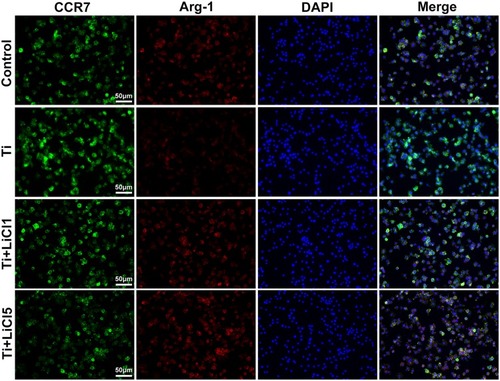 Figure 3 Immunofluorescence staining of RAW cells.Notes: CCR7 (green fluorophore) indicates M1 macrophages; Arg-1 (red fluorophore) indicates M2 macrophages; nuclei are stained with DAPI (blue fluorophore), scale bar: 50 μm.Abbreviations: CCR7, C-C chemokine receptor type 7; Arg-1, arginase-1; DAPI, 4ʹ,6-diamidino-2-phenylindole.