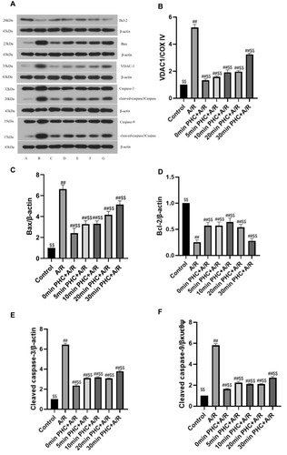 Figure 9 Western blot analysis of VDAC1, Bcl-2, Bax, cleaved caspase-3 and cleaved caspase-9 (A). As depicted in the above pictures, there is a decrease of Bcl-2, an increase of Bax, caspase-3 and caspase-9 in A/R group compared with the control group. As depicted by Western blot, PHC significantly attenuated the apoptosis pathway, and administering PHC at 30 mins after the reoxygenation showed the least effect compared with other postcondition groups (P<0.01, respectively). (B–F) (n=6; ##P < 0.01 versus control group, $$P < 0.01 versus A/R group. Data are shown as mean±S.D.).