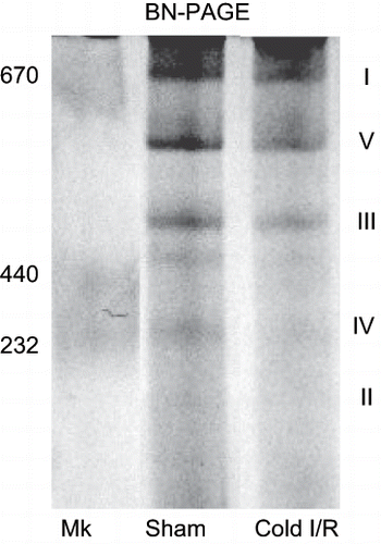 Figure 6 Blue native gel electrophoresis (BN-PAGE) showing alterations in mitochondrial complex proteins following cold I/R (40 min cold preservation  +  18 hr reperfusion). Renal mitochondria (80 μg) isolated from rat kidney tissue were electrophoresed (6% native), stained, and destained. The roman numerals represent the migration of mitochondrial electron transport complexes (I-NADH Dehydrogenase; V-ATP synthase, III-Ubiquinol-Cytochrome c Oxidoreductase). The gel is representative of three separate experiments. Mk = molecular weight markers.
