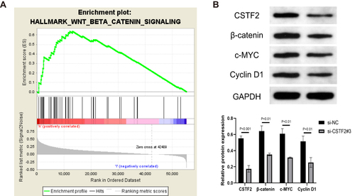 Figure 9 CSTF2 silencing inactivated the Wnt/β-catenin signaling pathway. (A) GSEA revealed that the Wnt/β-catenin signaling pathway was enriched in CSTF2 high expression group based on TCGA-LIHC cohort. (B) CSTF2 and Wnt/β-catenin signaling pathway-related protein expression in transfected HepG2 cells.