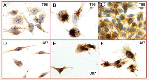 Figure 3. T98 (4A) and U87 (4D) glioblastoma cells in optimal culture conditions. Exposure to 2DG resulted in dramatic increases of LC3A and LC3B, with evident accumulation of SLS, in both cell lines (T98: 4B; U87: 4E). Low pH on the other hand induced SLS in the U87 cell line (4F) but not in the T98 (4C).