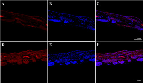 Figure 8. Nile red transdermal penetration of the skin as observed by laser confocal microscopy (Blank (A) Nile Red; (B) DAPI; (C) Nile Red + DAPI; MNs (D) Nile Red; (E) DAPI; (F) Nile Red + DAPI).