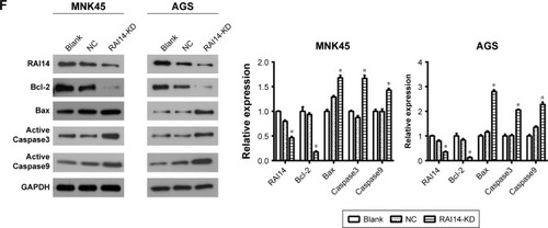 Figure 2 RAI14 knockdown inhibits cell migration and invasion, promotes apoptosis of gastric cancer cells.