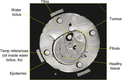 Figure 2. MRI cross-section of patient's lower leg inside 4 antenna MAPA applicator.