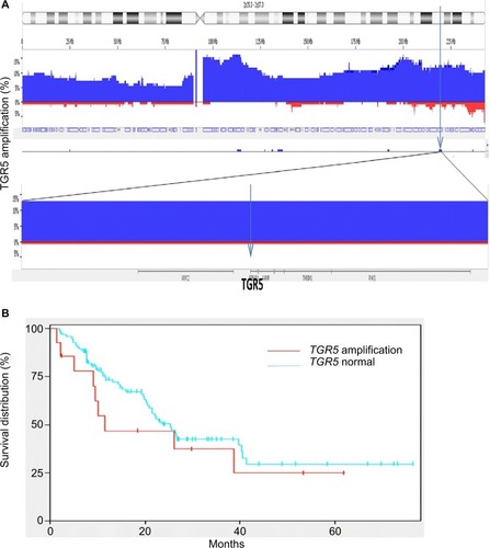 Figure 4 TGR5 amplification and overall survival.Notes: (A) Frequency histogram indicates amplification of the TGR5 locus at chromosome 2q35 in 116 esophageal adenocarcinoma samples, using high density copy number DNA microarrays. This locus is amplified in 14/116 (12.7%) cases in this patient cohort. (B) There is no significant association between TGR5 amplification and overall survival (p=0.33).