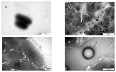 Figure 5 TEM image of Listeria monocytogenes and platinum (Pt) nanoparticles: a) control; b, c, and d) Listeria monocytogenes with nano-Pt. Arrows point to nano-PT (b and c); and to black spot partially evaporated under microscope electron beam (b).