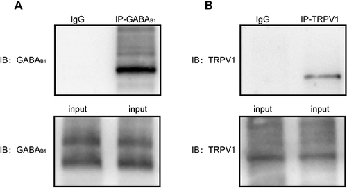 Figure 3 Western blot analysis for the products of Co-IP and reverse Co-IP. GABAB1 receptors and TRPV1 receptors in the CSF-contacting neurons are physically linked to each other and form a complex. (A) Immunoprecipitations of tissue lysates derived from the CSF-contacting neurons using TRPV1 antibody followed by Western blot are probed with anti- GABAB1 antibody. (B) Immunoprecipitations of tissue lysates derived from the CSF-contacting neurons using GABAB1 antibody followed by protein blotting with anti-TRPV1 antibody. “Input” served as a positive control, and “IgG” served as a negative control.