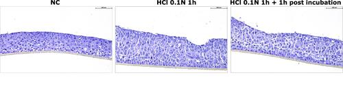 Figure 2 H&E staining performed on HO2E/12 treated with buffered saline solution (NC), with HCl 0.1N during 1h (series HCl 0.1N 1h) or with HCl 0.1N followed by a post incubation period of 1h (series HCl 0.1N 1h + 1h post incubation). Magnification 20x. Scale bar = 100 μm.