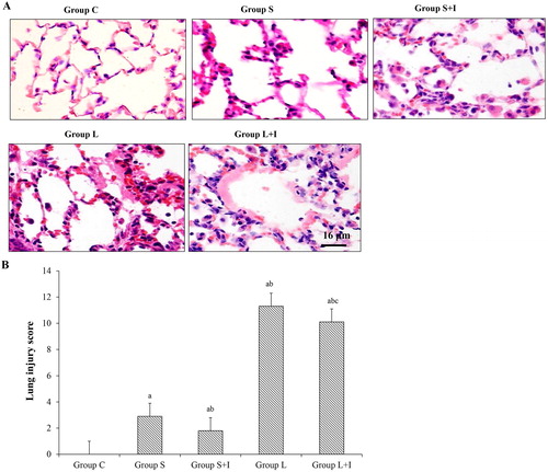 Figure 1. Pathological changes of lung tissue in different groups. Representative H&E staining results (A) and lung injury score (B).Note: Scale bar = 16 μm; ap <0.05 vs. Group C; b p <0.05 vs. Group S; c p <0.05 vs. Group L. Data are means ± SD, n = 10 in each group.