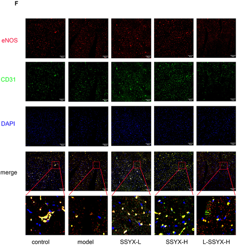 Figure 9 Effects of SSYX on the protein expression of ZO-1, eNOS, occludin, the mRNA expression of ET-1, NO content, and the expression of CD31 and eNOS observed by immunofluorescence double staining in the heart tissue. The protein expression of (A) ZO-1, (B) eNOS, and (C) occludin in each group. (D) The ET-1 mRNA expression in each group. (E) The NO content in each group. (F) Representative images of immunofluorescence double staining for each group. ENOS, CD31, and DAPI were marked in red, green, and blue respectively. The overlap parts of CD31 and eNOS were marked in yellow (200×). Values measured are presented as the mean ± SD (n = 3). **P < 0.01 vs control group. *P < 0.05 vs control group. ##P < 0.01 vs model group. #P < 0.05 vs model group. $$P < 0.01 vs SSYX-H group. $P < 0.05 vs SSYX-H group.