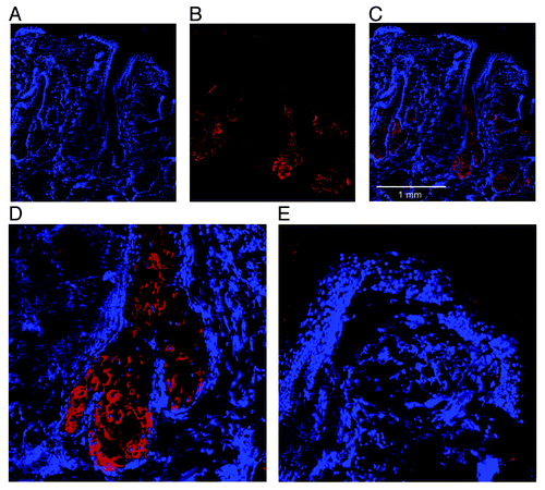 Figure 4. 3β-HSD type I expression in vivo. Skin biopsies of human scalp skin were cryosectioned. DAPI staining (A) was used to visualize histological structures. Positive 3β-HSD type I immunoreactivity was confirmed using an anti-3β-HSD type I antibody (B). A merge image (C) of DAPI staining and 3β-HSD type I immunoreactivity showed that the immunoreactivity was restricted to sebaceous glands and lower parts of the hair follicle duct, which is confirmed by a magnification of a sebaceous gland (D) and epidermis (E).