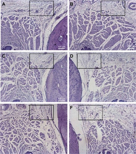 Figure 3 Histological analysis of the upper right first molar oral mucosa in rats 6 hours after local anesthetic administration: (B) BVC; (D) BVCALG; (F) NPALG. The left side was respectively used as control: (A) control BVC; (C) control BVCALG; (E) control NPALG.