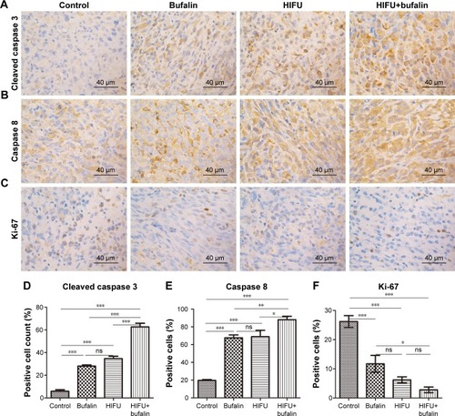 Figure 4 HIFU inhibits cell proliferation and increases cell death in MiaPaCa2 xenograft tumors. Tumors from mice treated with vehicle, bufalin, HIFU, or HIFU+bufalin for 35 days were subjected to immunohistochemical staining with cleaved caspase-3 (A and D), caspase-8 (B and E), and Ki-67 (C and F) antibodies.Notes: All images are representative of three independent experiments. Scale bar=50 µm. *P<0.05, **P<0.01, and ***P<0.0001, one-way ANOVA. Abbreviations: HIFU, high-intensity focused ultrasound; ns, nonsignificant.
