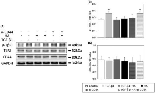 Figure 8. Hyaluronan-mediated down-regulation of phosphorylation of TβR1 is prevented with blocking antibodies to CD44. CD44, phospho-TβR1 and TβR1 expressions are examined by western blot analyses (A). Densitometric analysis is shown (B). Results are expressed as the mean ± SD and significant differences are indicated by asterisk (p< .05). α-CD44: blocking antibodies to CD44. TβR1: type 1 transforming growth factor receptor.